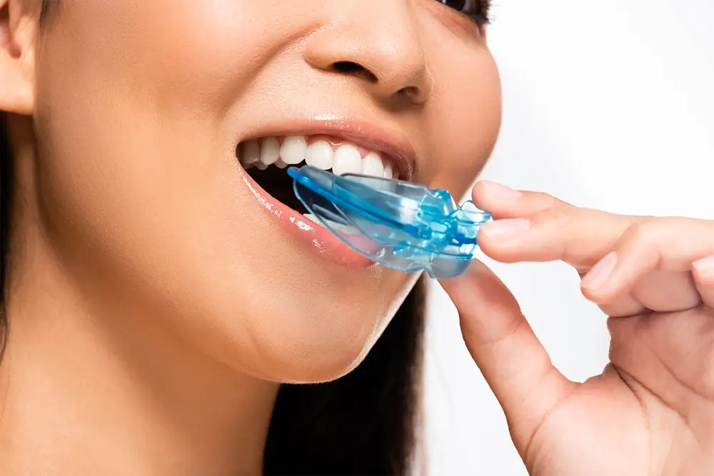 Mouth Guard